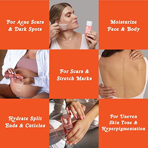 Bio-Oil Body Oil for Scars & Stretchmarks 100 Deals